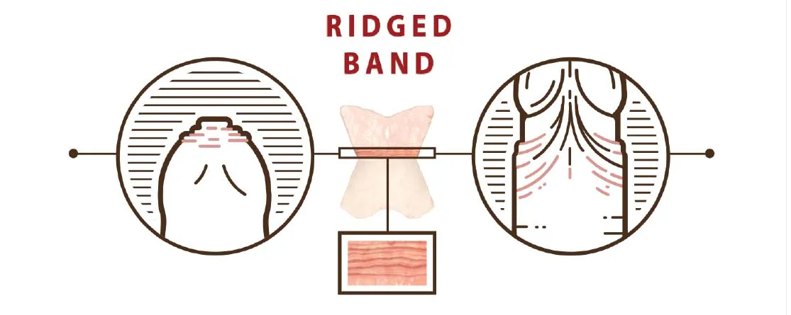 The Ridged Band